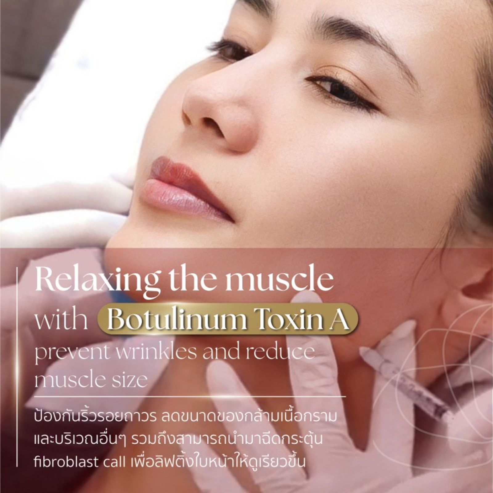 Facial Reshaping Non-Surgical Treatment การปรับรูปหน้าโดยไม่ต้องผ่าตัด — ภาพประกอบ 03