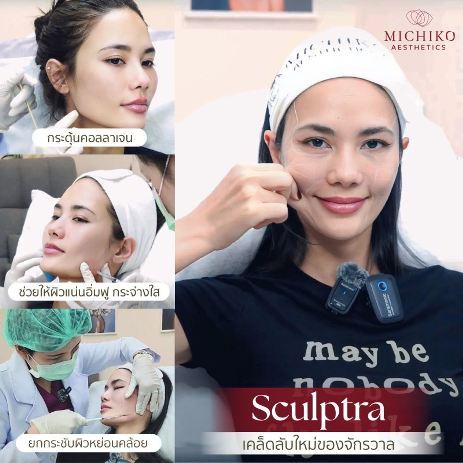เคล็ดลับใหม่ของจักรวาล Sculptra ทำให้หน้าเด็กมากกก — ภาพประกอบ 02