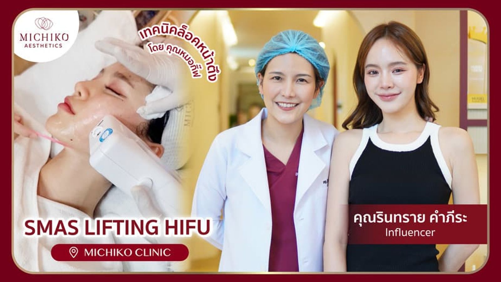 [รีวิว] แก้มกลมเป็นซาลาเปา กรอบหน้าไม่ชัด แก้ไขได้ด้วยการทำ HIFU ยกกระชับ โดย คุณหมอกิ๊ฟ