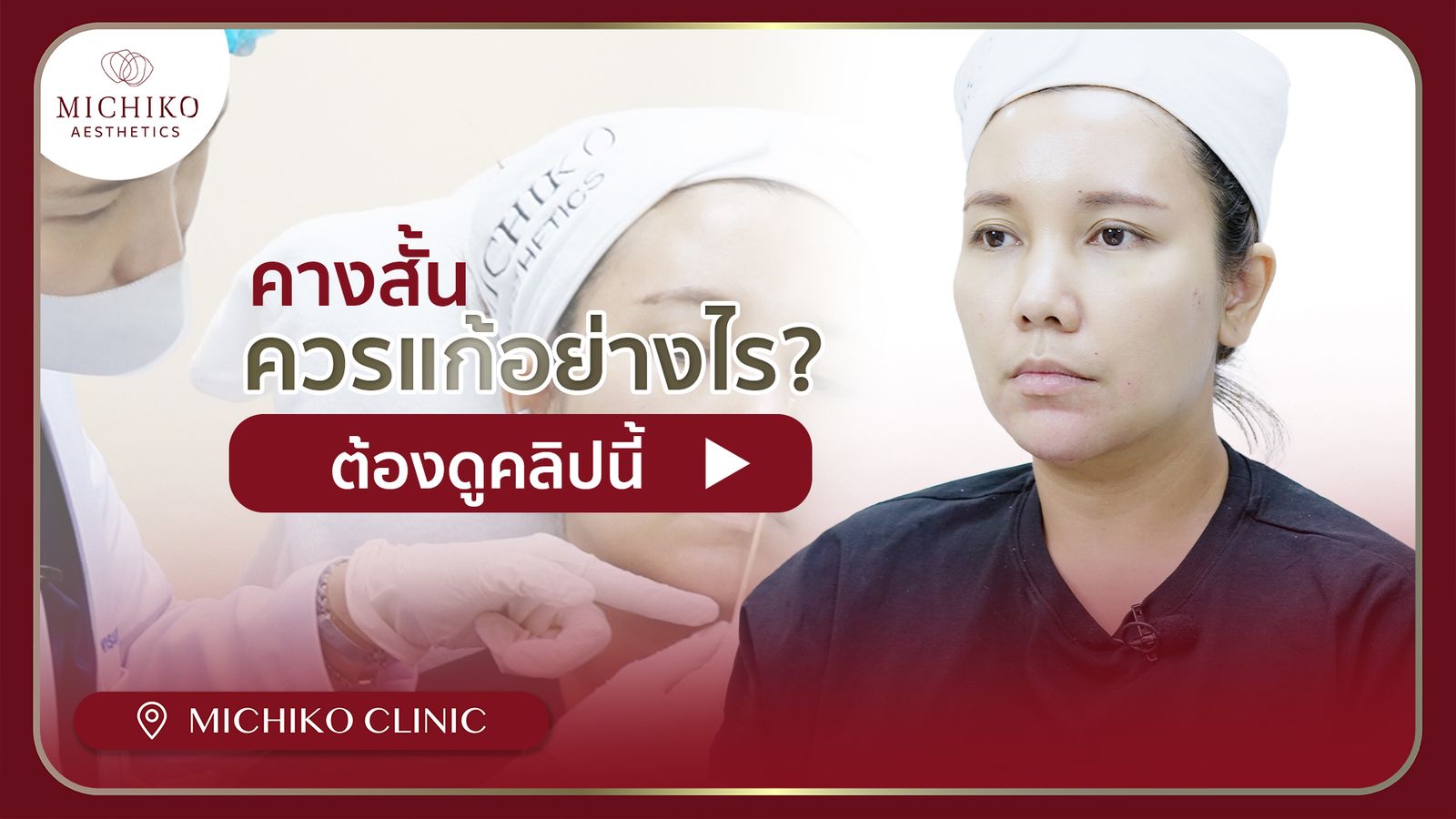 [รีวิว] คางสั้น ใช้ฟิลเลอร์แก้ได้ !!