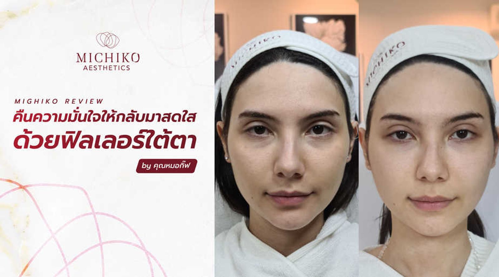 [รีวิว] คืนความมั่นใจให้ คุณแม่ที่เลี้ยงลูกจนใต้ตาลึกให้กลับมาสดใส