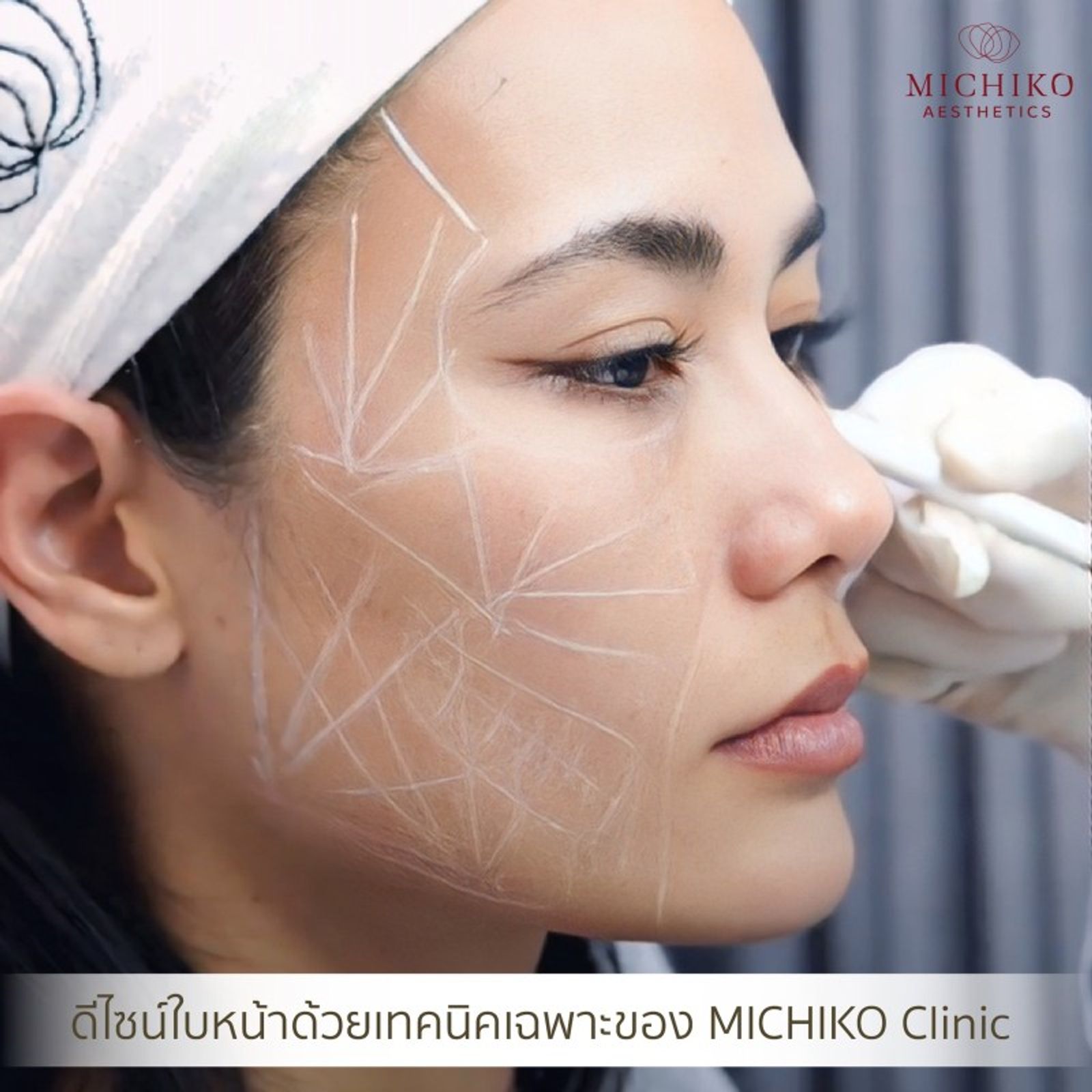 เคล็ดลับใหม่ของจักรวาล Sculptra ทำให้หน้าเด็กมากกก — ภาพประกอบ 01