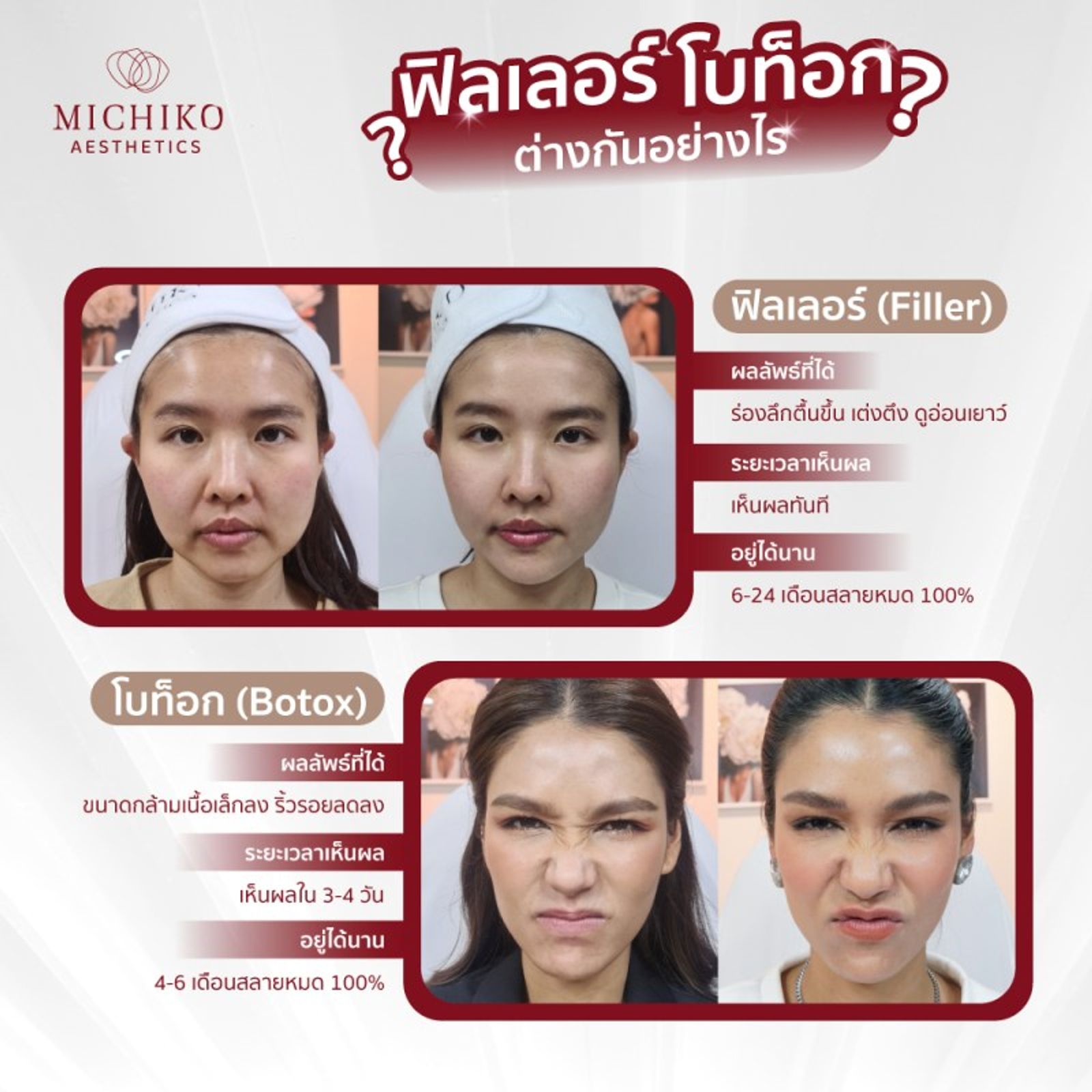 Filler กับ Botox ต่างกันอย่างไร? ทำพร้อมกันได้หรือไม่？ — ภาพประกอบ 03
