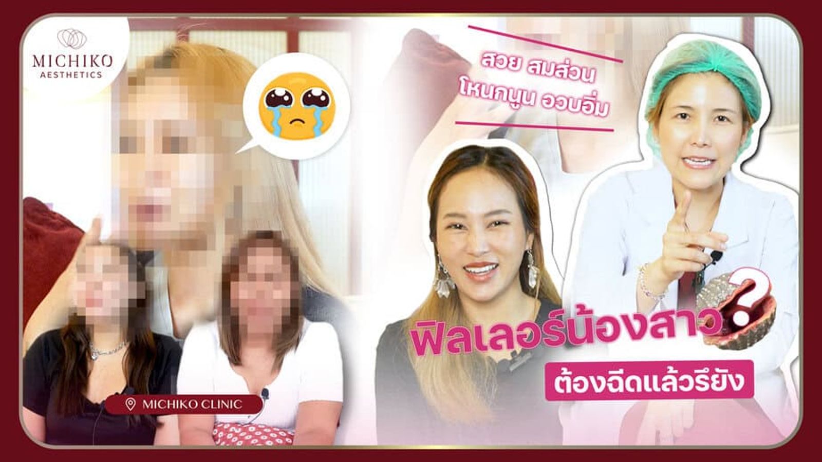 [รีวิว] ฟิลเลอร์น้องสาว !!! ฉีดแล้วอูม ฉีดแล้วมั่นใจสุ๊ดดด