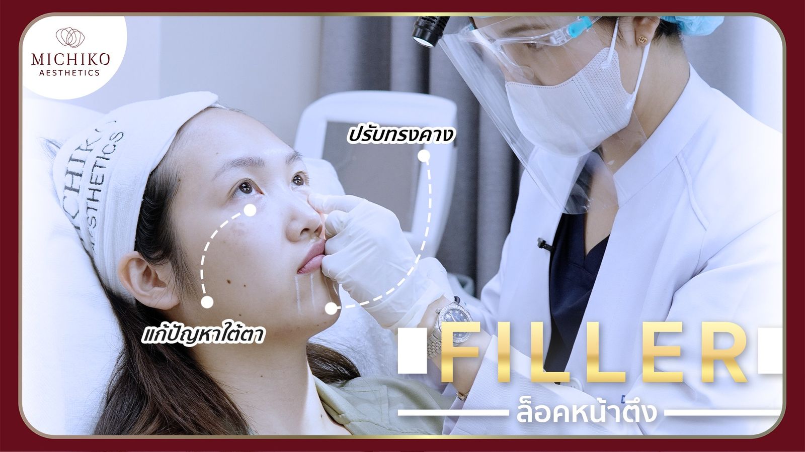 [รีวิว] เสกสาวหน้ากลม ให้หน้าเรียว ด้วยฟิลเลอร์ !!!