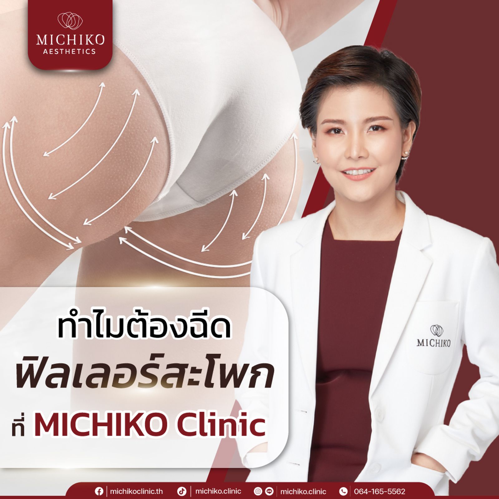 ฟิลเลอร์สะโพก เสริมสะโพกสวยๆ โดยไม่ง้อศัลยกรรม