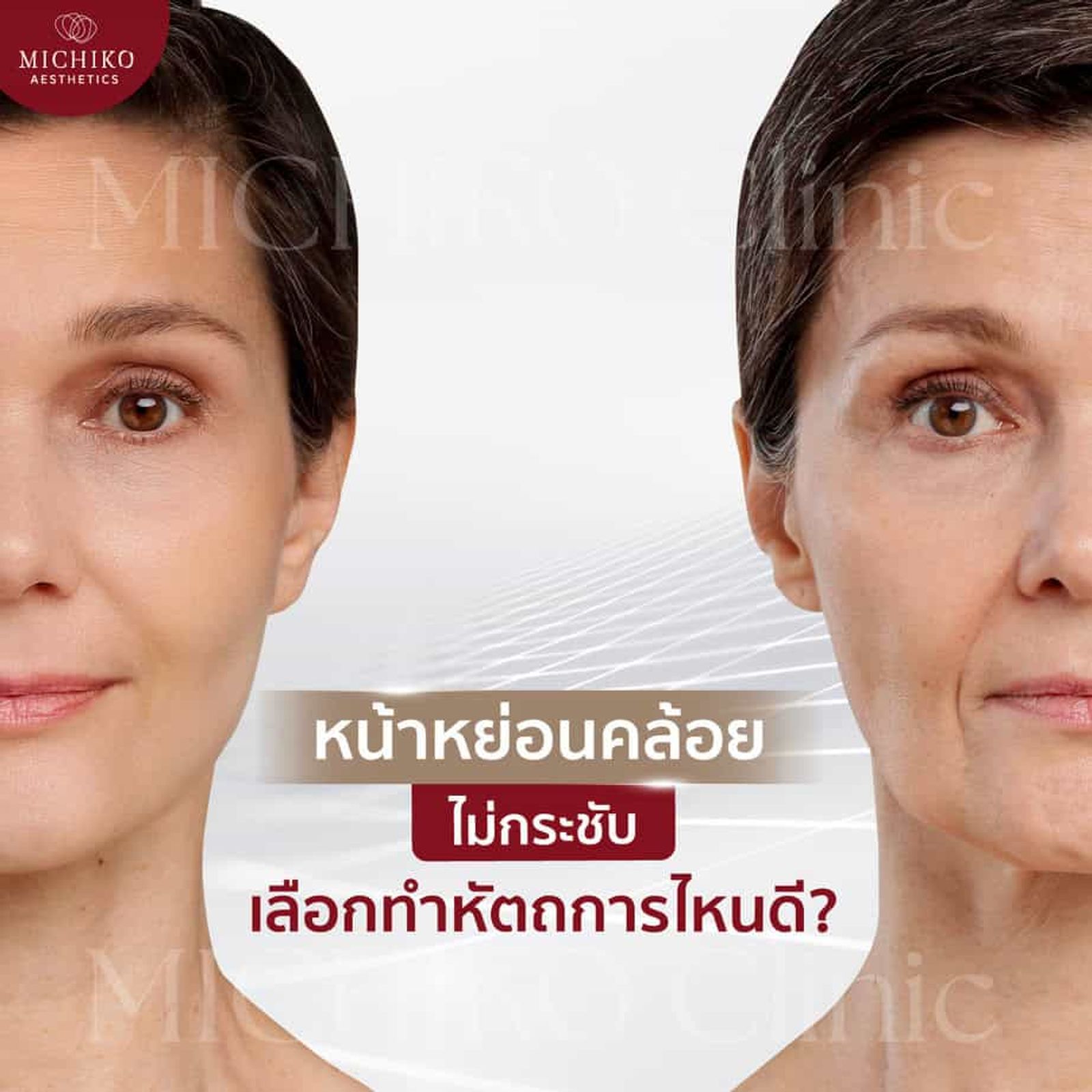 หน้าหย่อนคล้อย