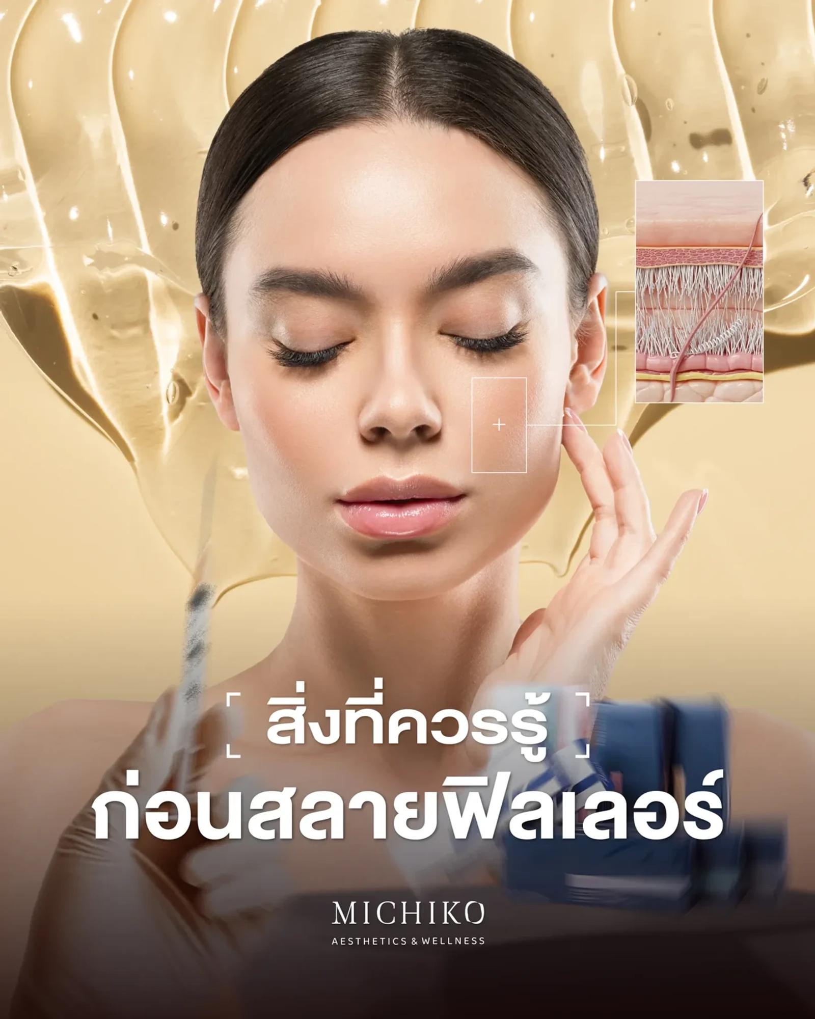MICHIKO guide: things to know before dissolving filler