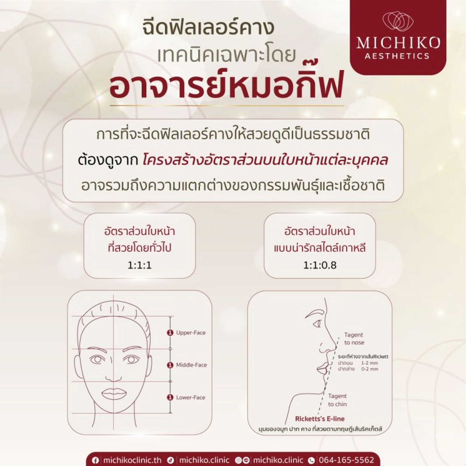 ฟิลเลอร์คาง