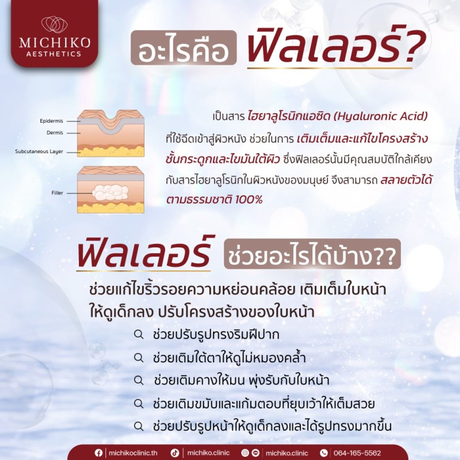 ฟิลเลอร์ช่วยอะไร