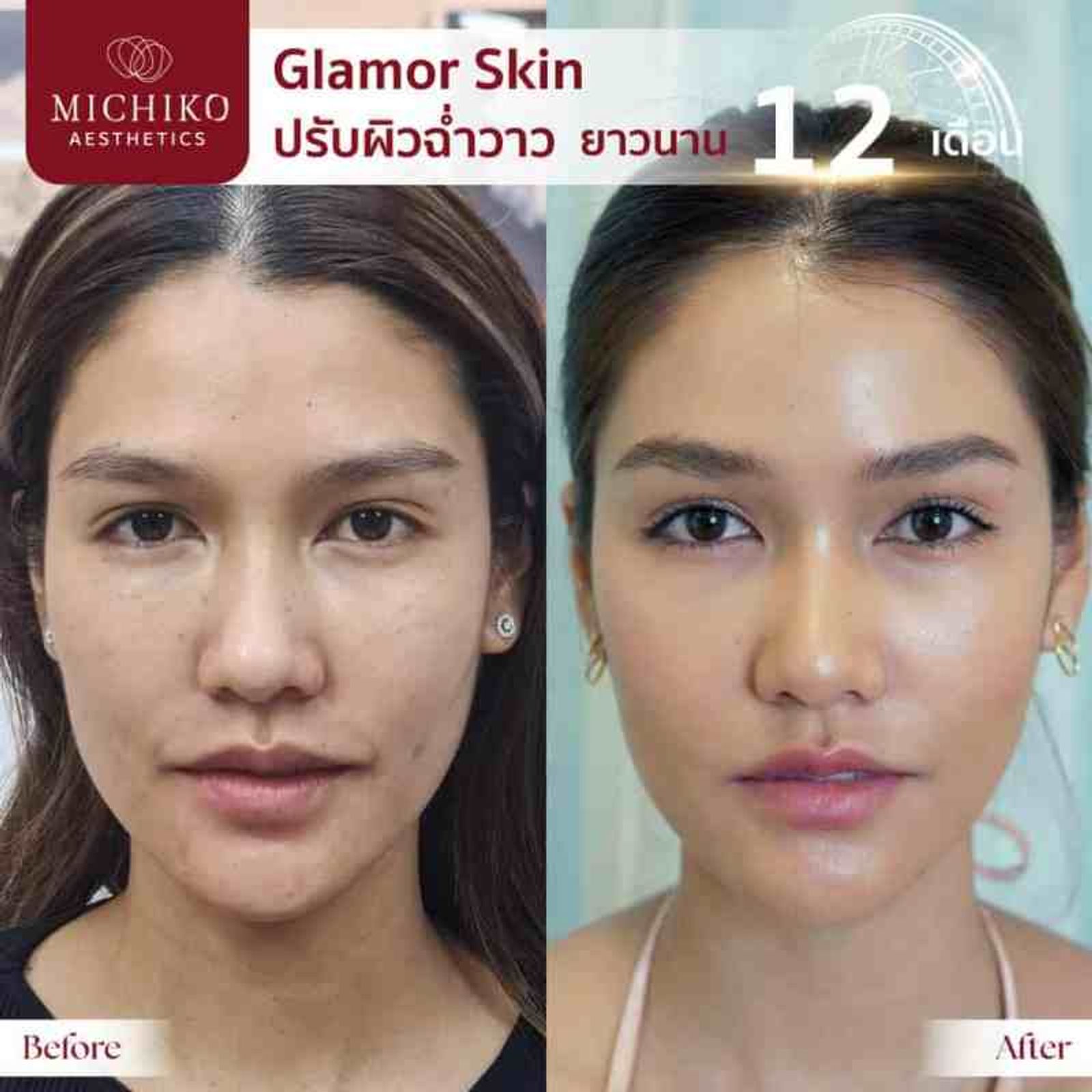 [รีวิว] Glamor Skin✨ ไขความลับ คุณแนท ความสวยระดับจักวาล — ภาพประกอบ 02