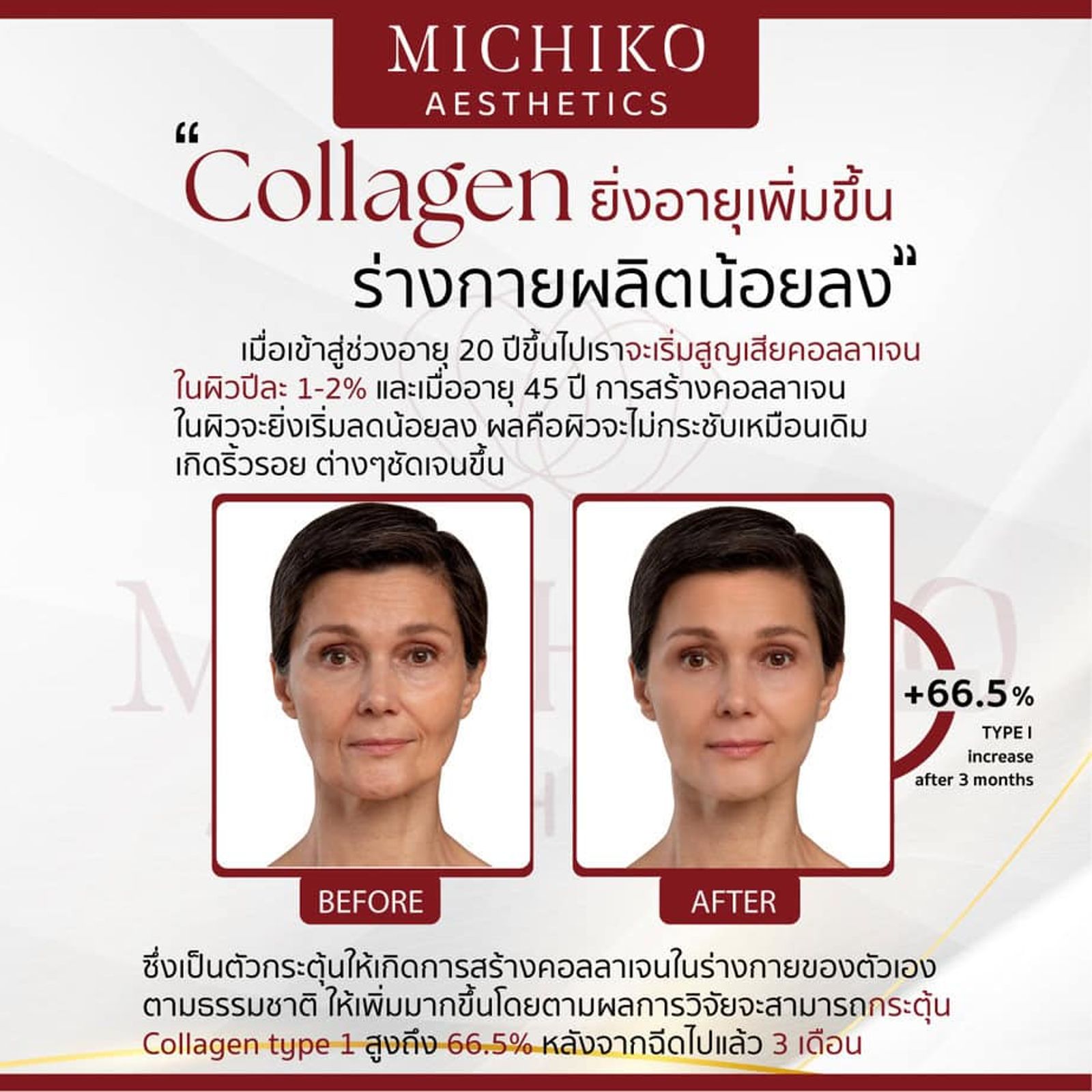 คอลลาเจนสำคัญต่อผิวอย่างไร? — MICHIKO