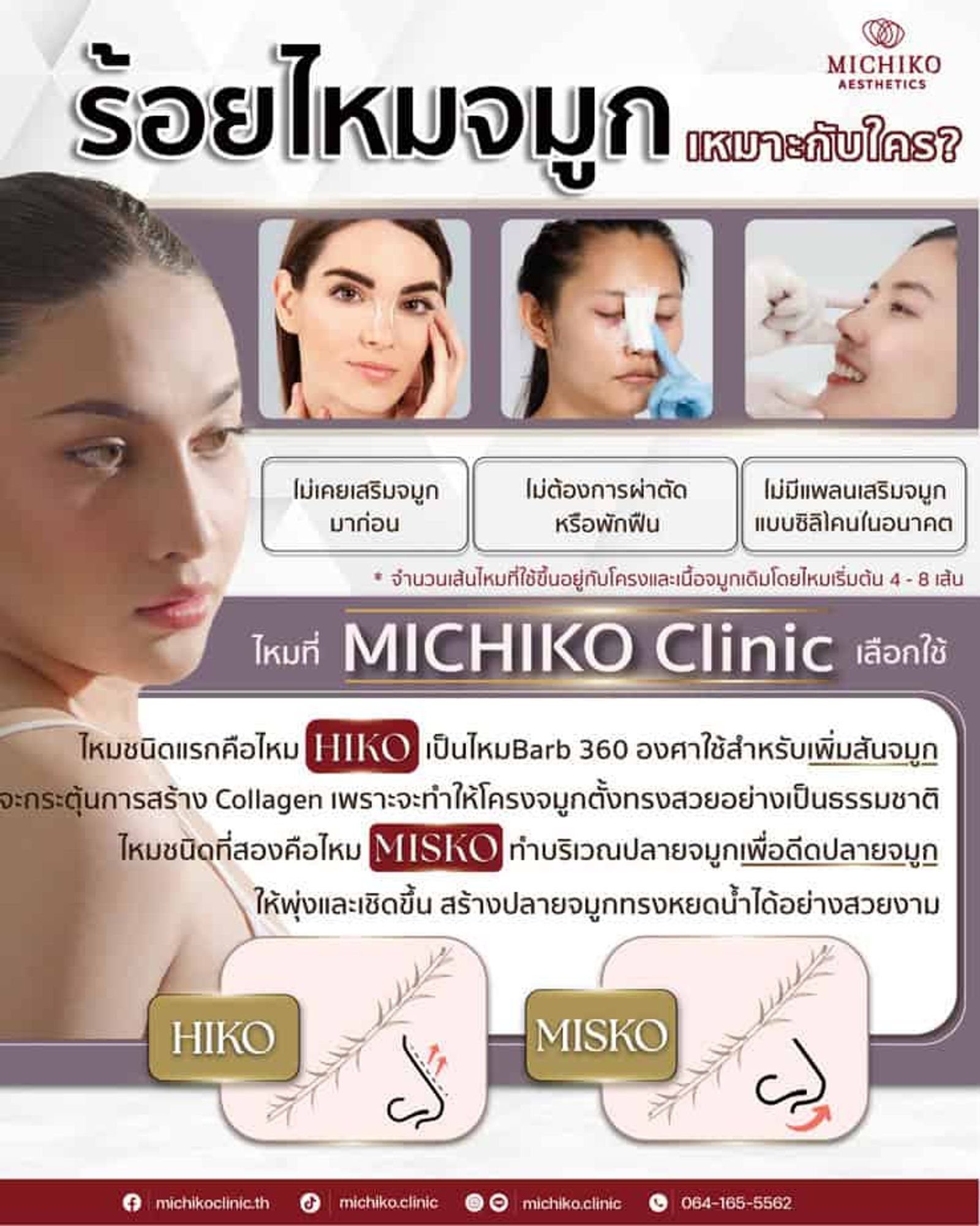 ร้อยไหม คืออะไร