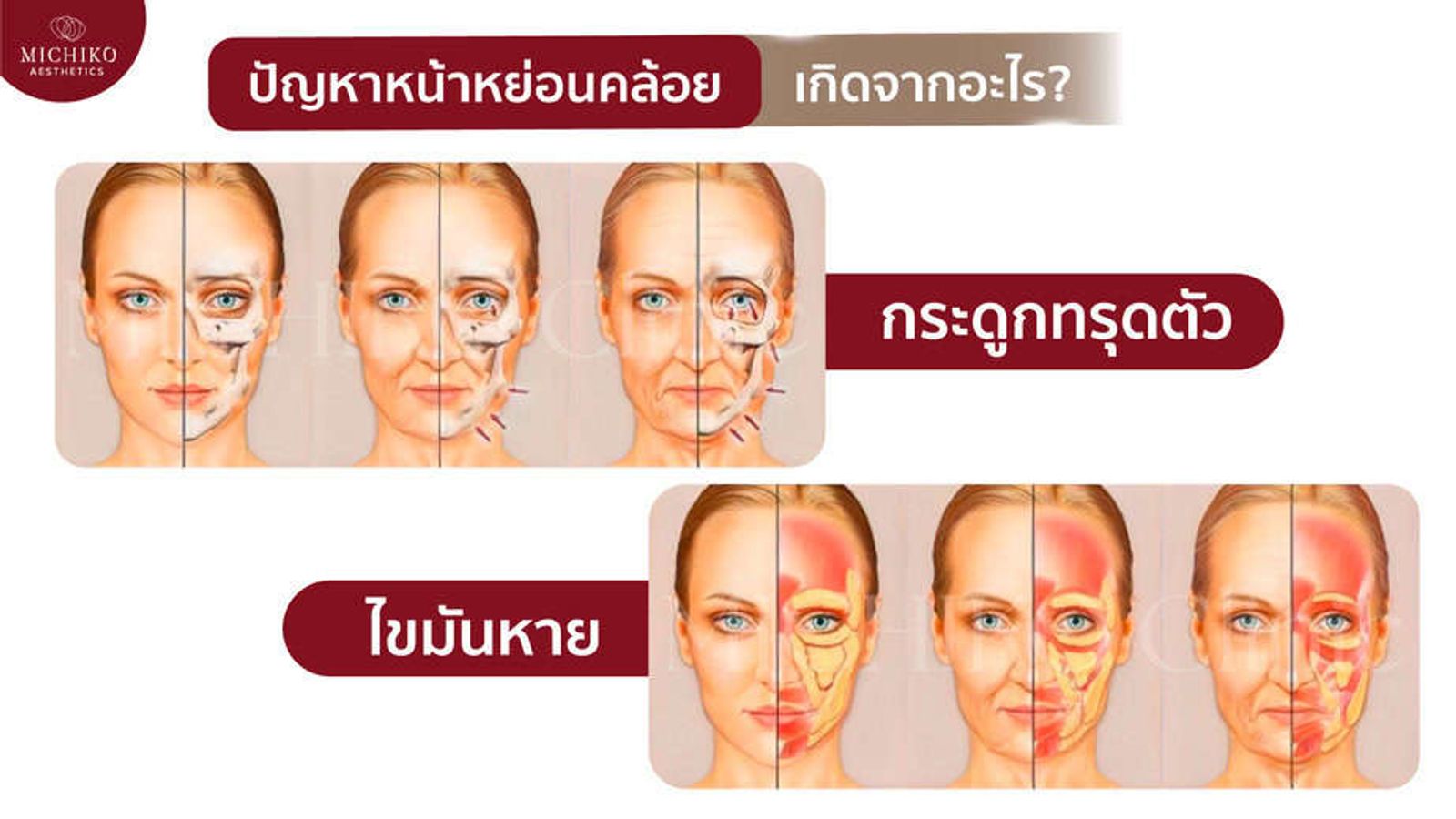 ปัญหาหน้าหย่อนคล้อย เกิดจากอะไร