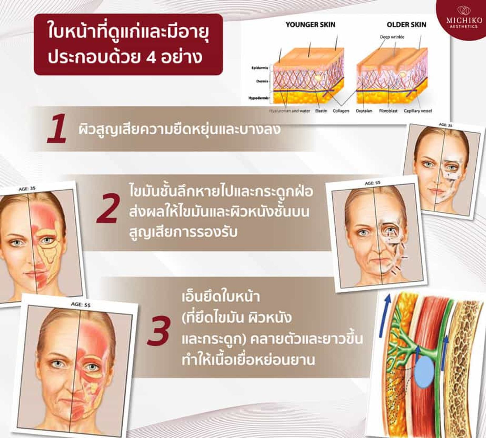 เทคนิค #ฟิลเลอร์ล็อคหน้าตึง คือการฉีดฟิลเลอร์แก้ไขโครงสร้าง ทำให้หน้ายกขึ้น อย่างเป็นธรรมชาติ — ภาพประกอบ 04