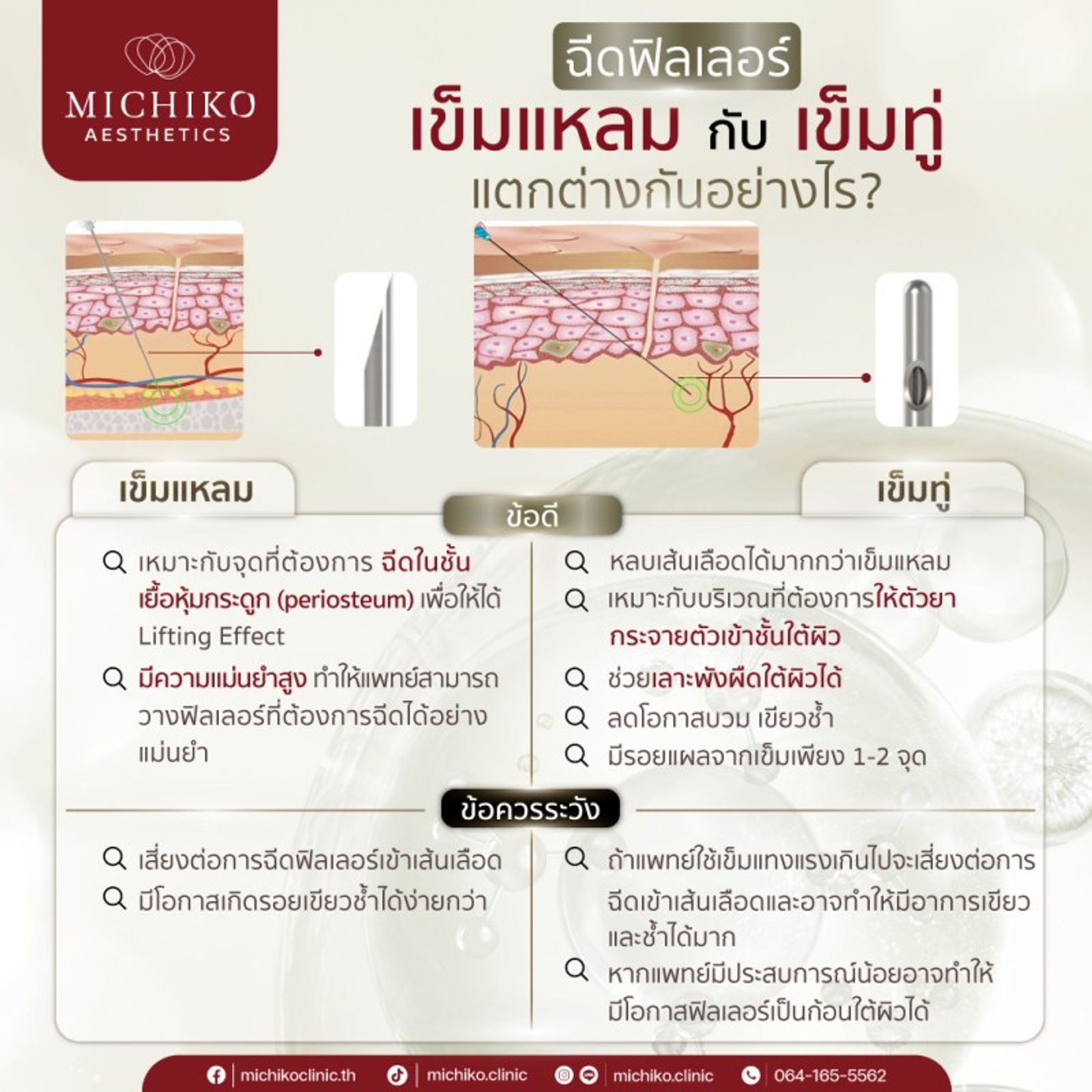 ฉีดฟิลเลอร์ เข็มแหลม เข็มทู่ ต่างกันอย่างไร