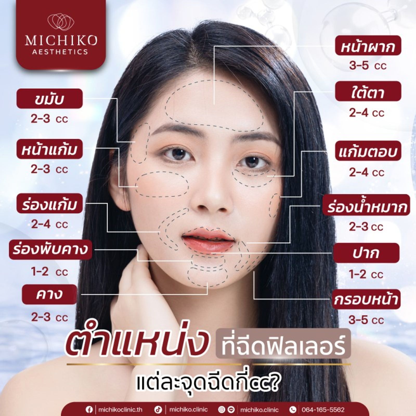 ฉีดฟิลเลอร์จุดไหนได้บ้าง