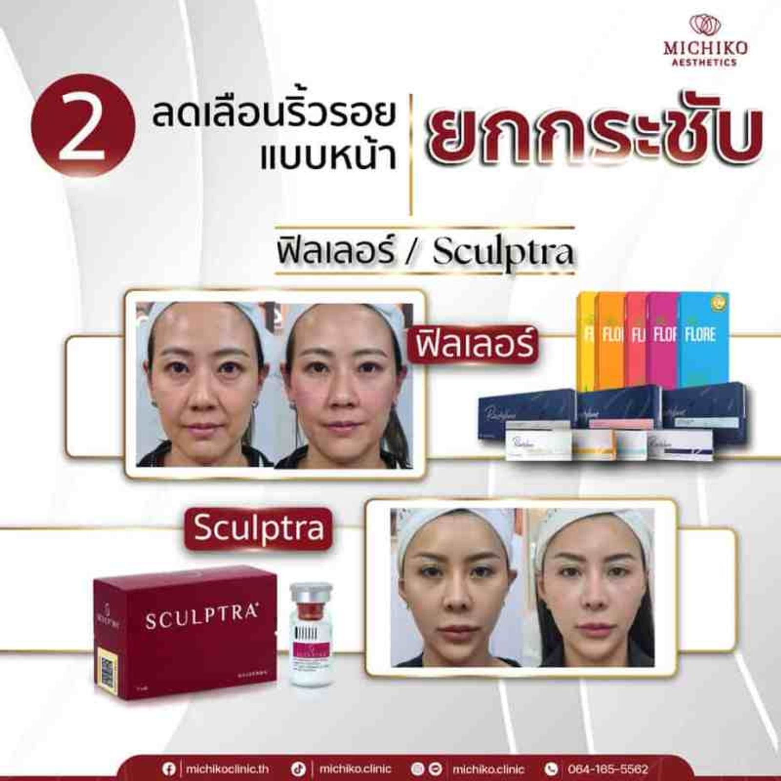 ลดริ้วรอย ฟิลเลอร์ sculptra