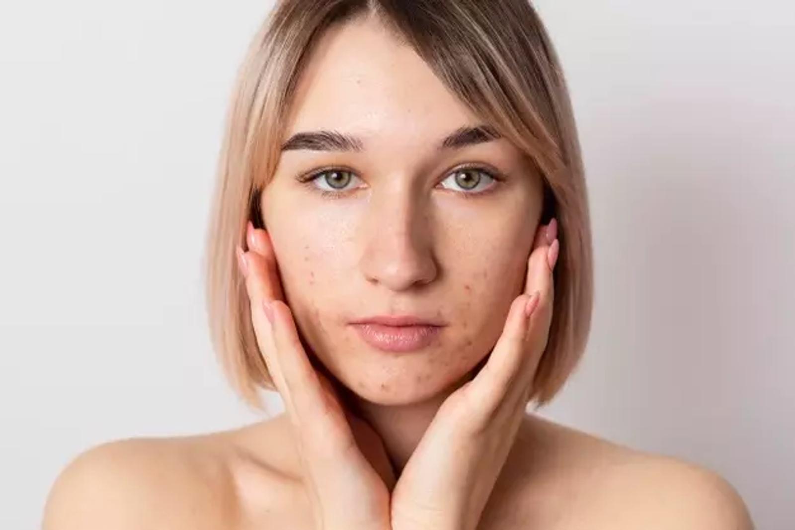 Illustrative skin portrait from MICHIKO’s Made Collagen guide