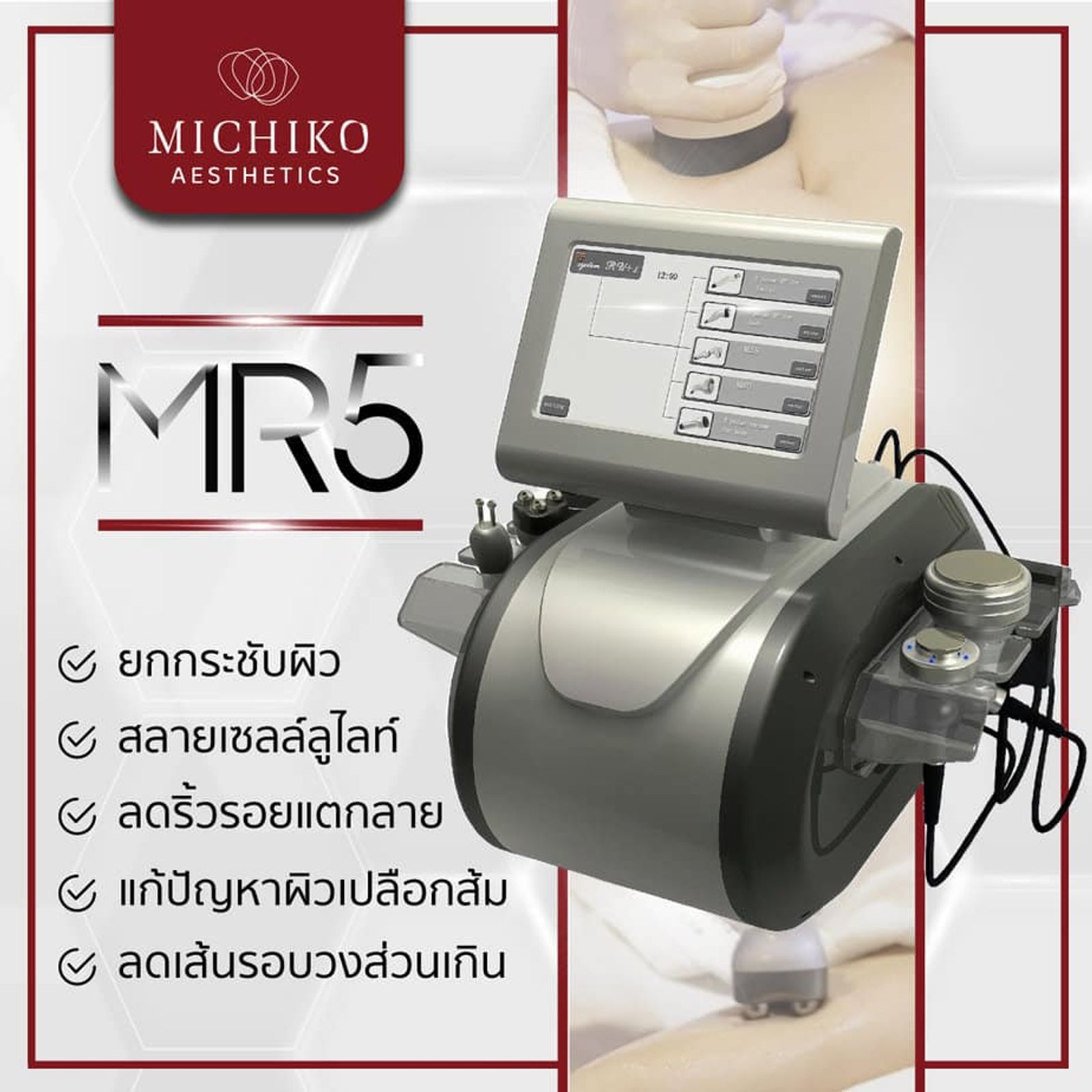 เครื่องตัวใหม่! MR5 เทคโนโลยีคลื่น High Frequency Ultrasound และคลื่นความถี่วิทยุ RFสลายไขมันส่วนเกินได้ยังไง?