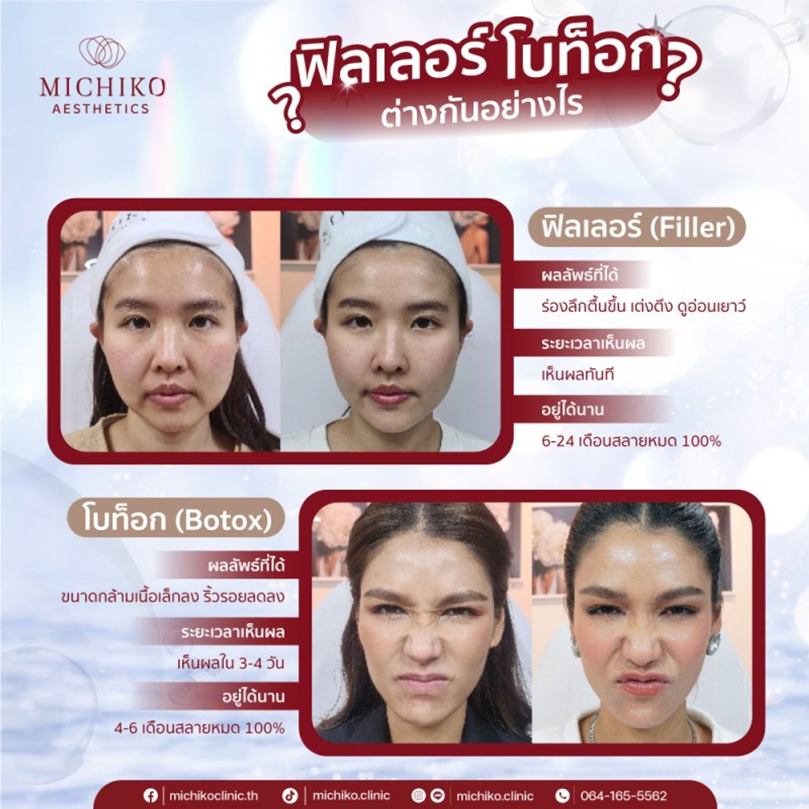 รวบรวมข้อควรรู้ทั้งหมดก่อนการฉีด #ฟิลเลอร์ EP.1 — ภาพประกอบ 09