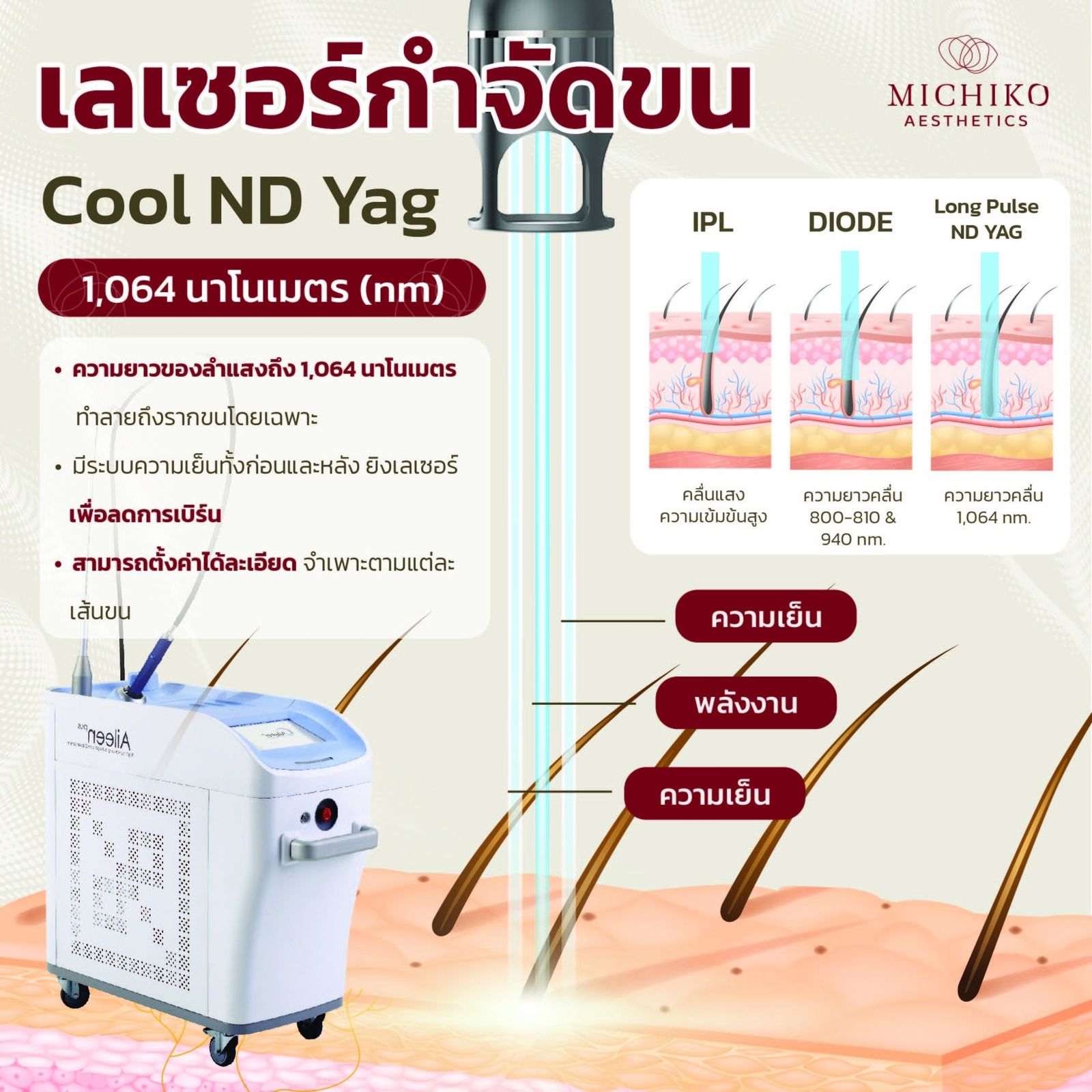 CoolNdYag กำจัดขนเหมือนกัน แต่ผลลัพธ์ที่ได้แตกต่างกัน !!