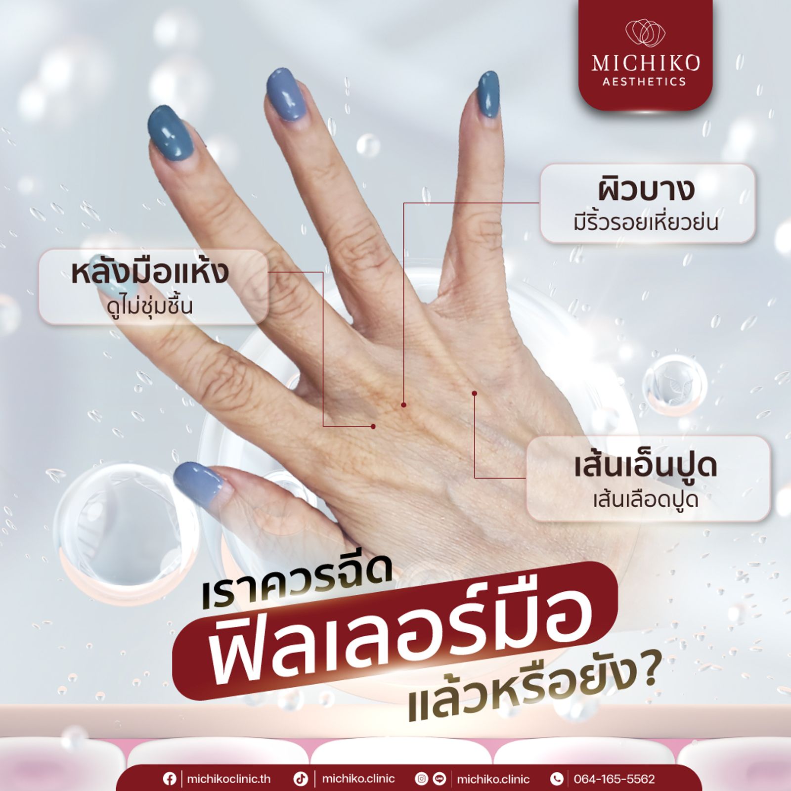 ฟิลเลอร์มือ