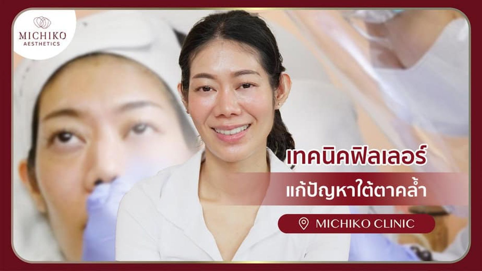 ฟิลเลอร์ใต้ตา