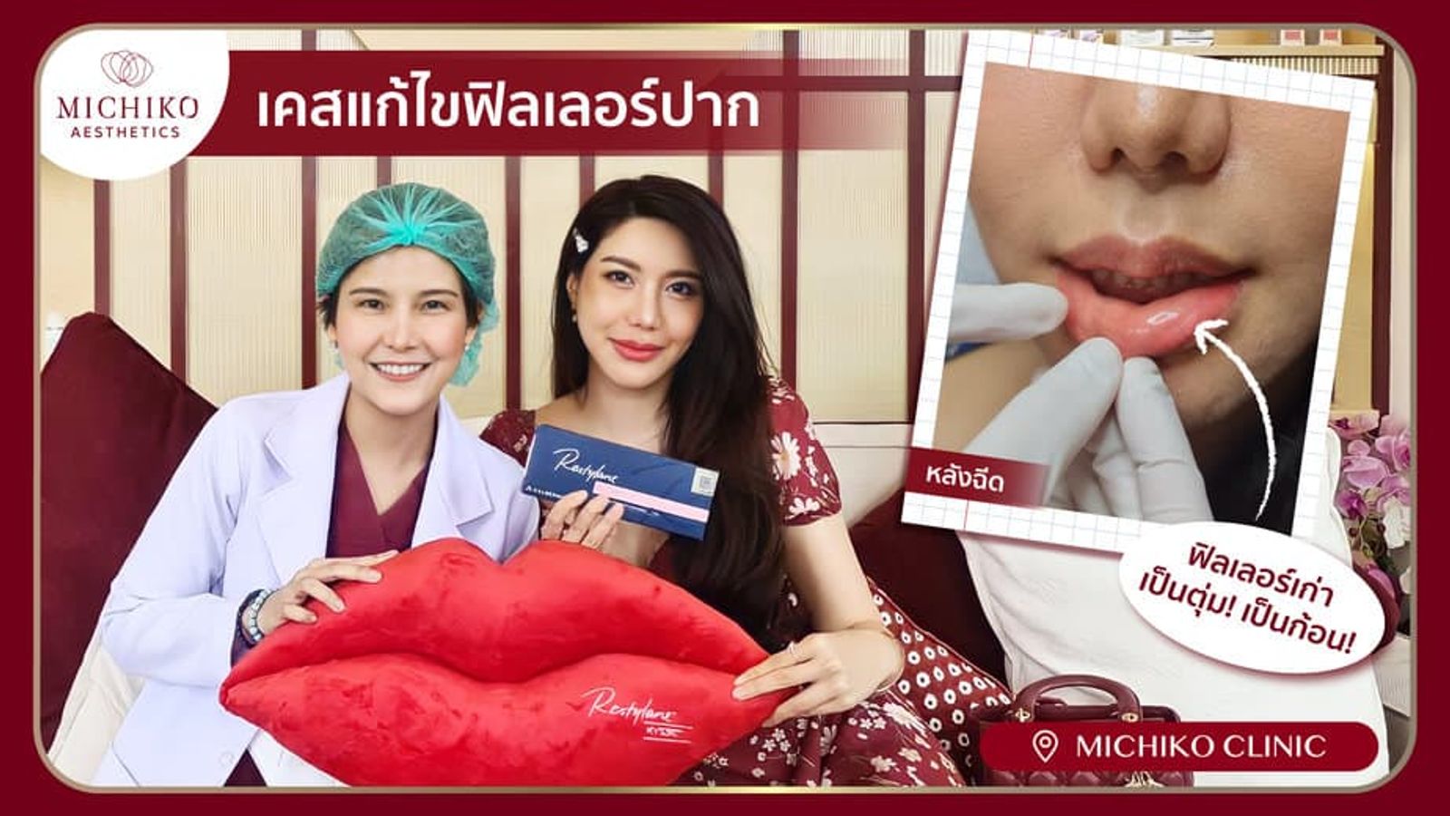 [รีวิว] ฉีดปากที่อื่นมาพัง!! แต่มาปังที่ มิชิโกะ เคสแก้ฟิลเลอร์ปาก โดยคุณหมอกิ๊ฟ
