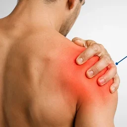 Shoulder Pain Physiotherapy