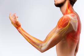 Cover image for blog post: Nerve Pain Explained: Pinched Nerves, Sciatica & Physiotherapy Solutions