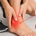 Ankle Pain Physiotherapy