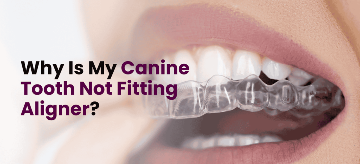 Why Is My Canine Tooth Not Fitting Aligner? 