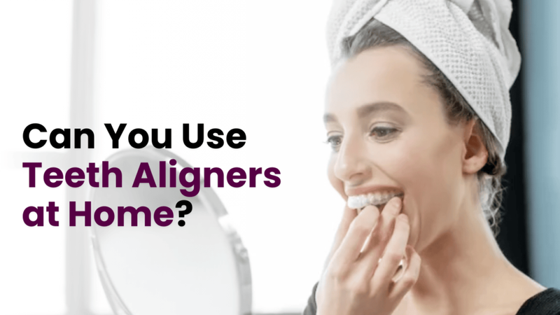 Can You Use Teeth Aligners at Home?