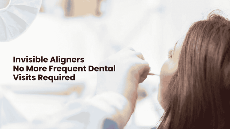 Invisible Aligners: No More Frequent Dental Visits Required