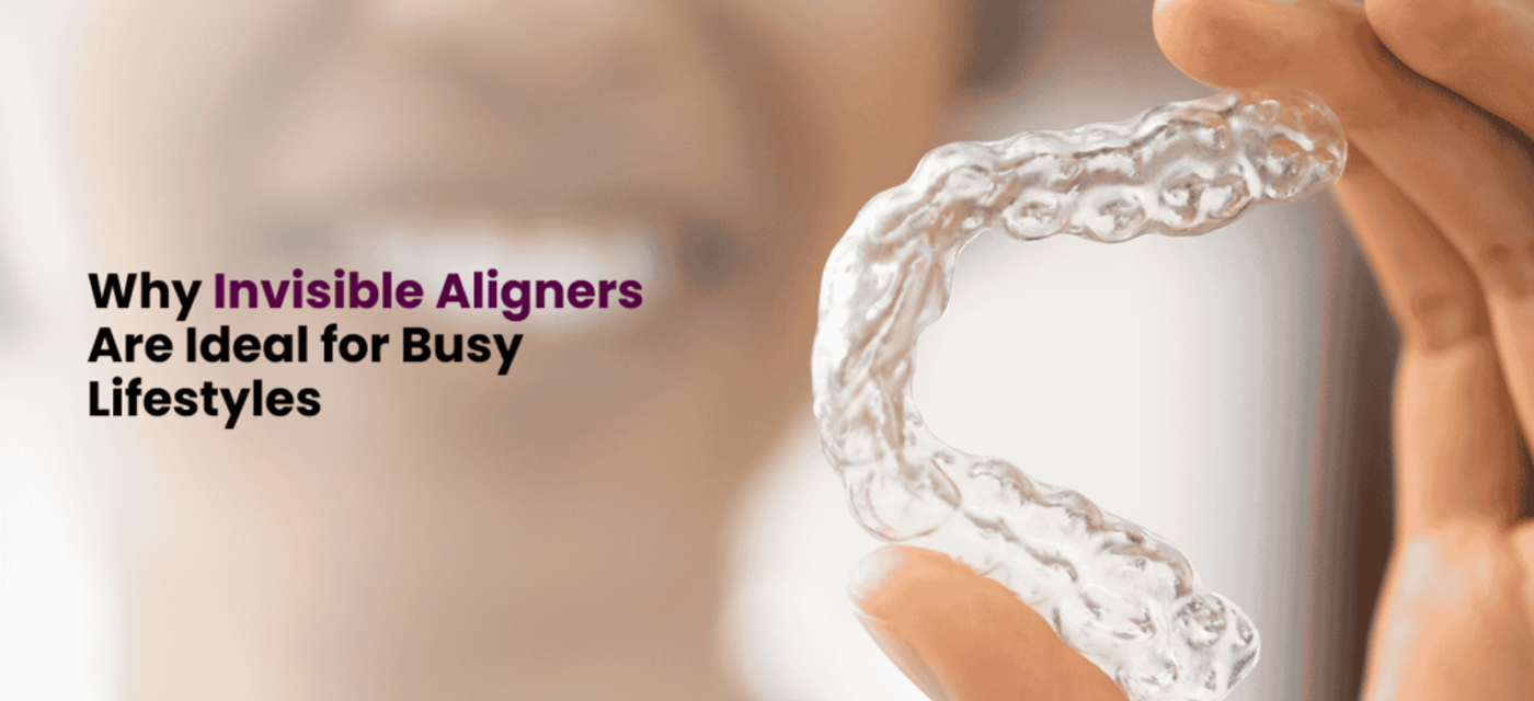 Why Invisible Aligners Are Ideal for Busy Lifestyles