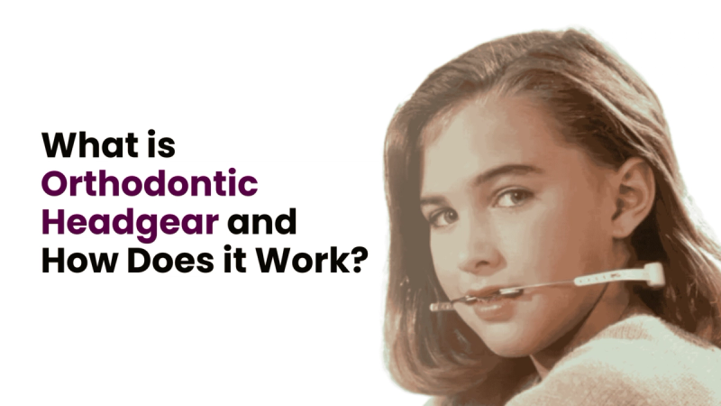What is Orthodontic Headgear and How Does it Work?