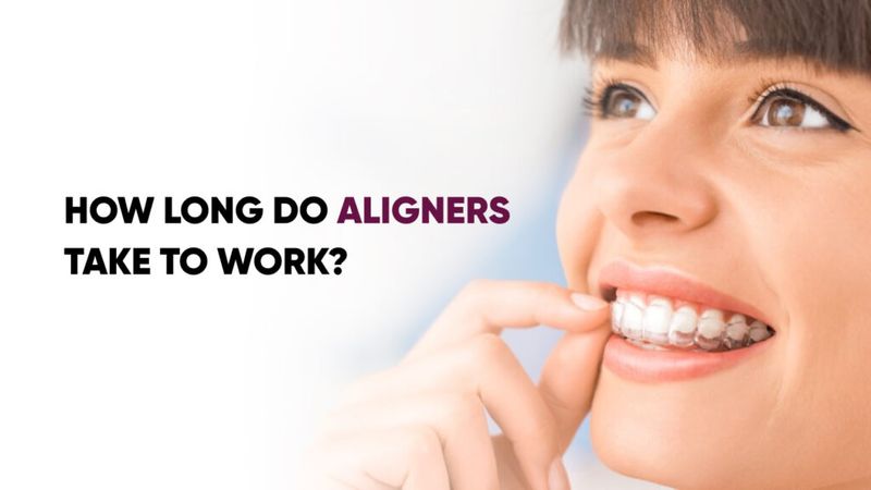 How Long Do Aligners Take to Work?