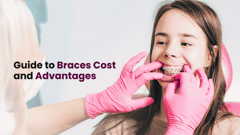 Braces Cost in Los Angeles: Best Orthodontists & Benefits