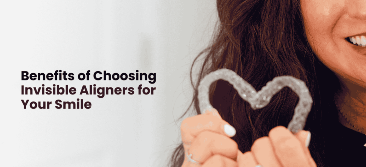 Benefits of Choosing Invisible Aligners for Your Smile