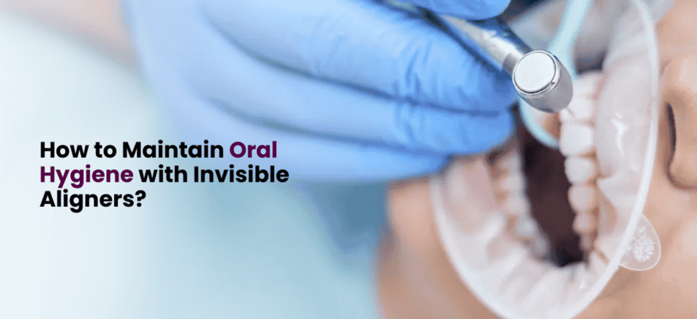 How to Maintain Oral Hygiene with Invisible Aligners?