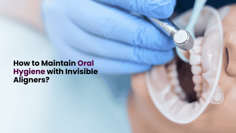 How to Maintain Oral Hygiene with Invisible Aligners?