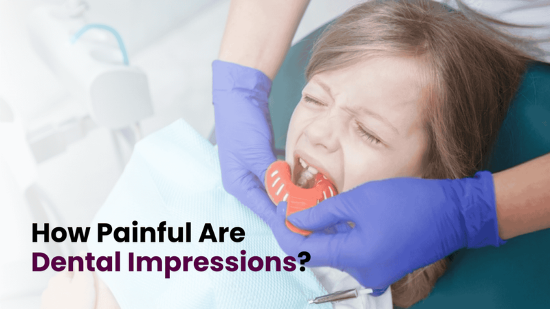 How Painful Are Dental Impressions?