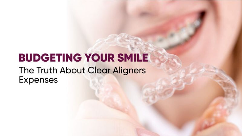 Budgeting Your Smile: The Truth About Clear Aligners Expenses