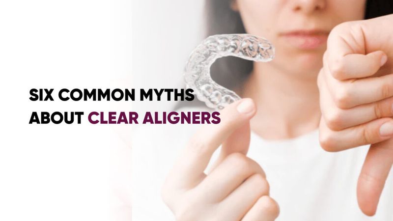 Six Common Myths About Clear Aligners