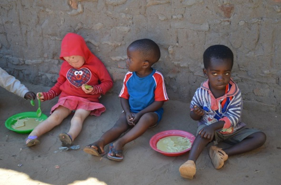 Children, one with albinism, eating porridge