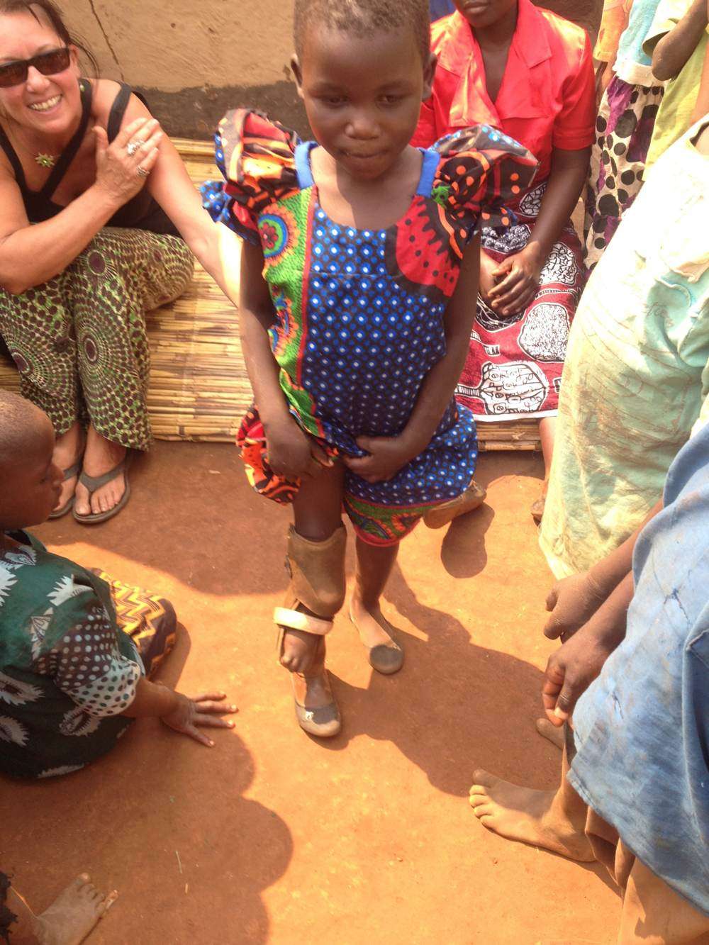 Jennifa – proud of her prosthetic leg!