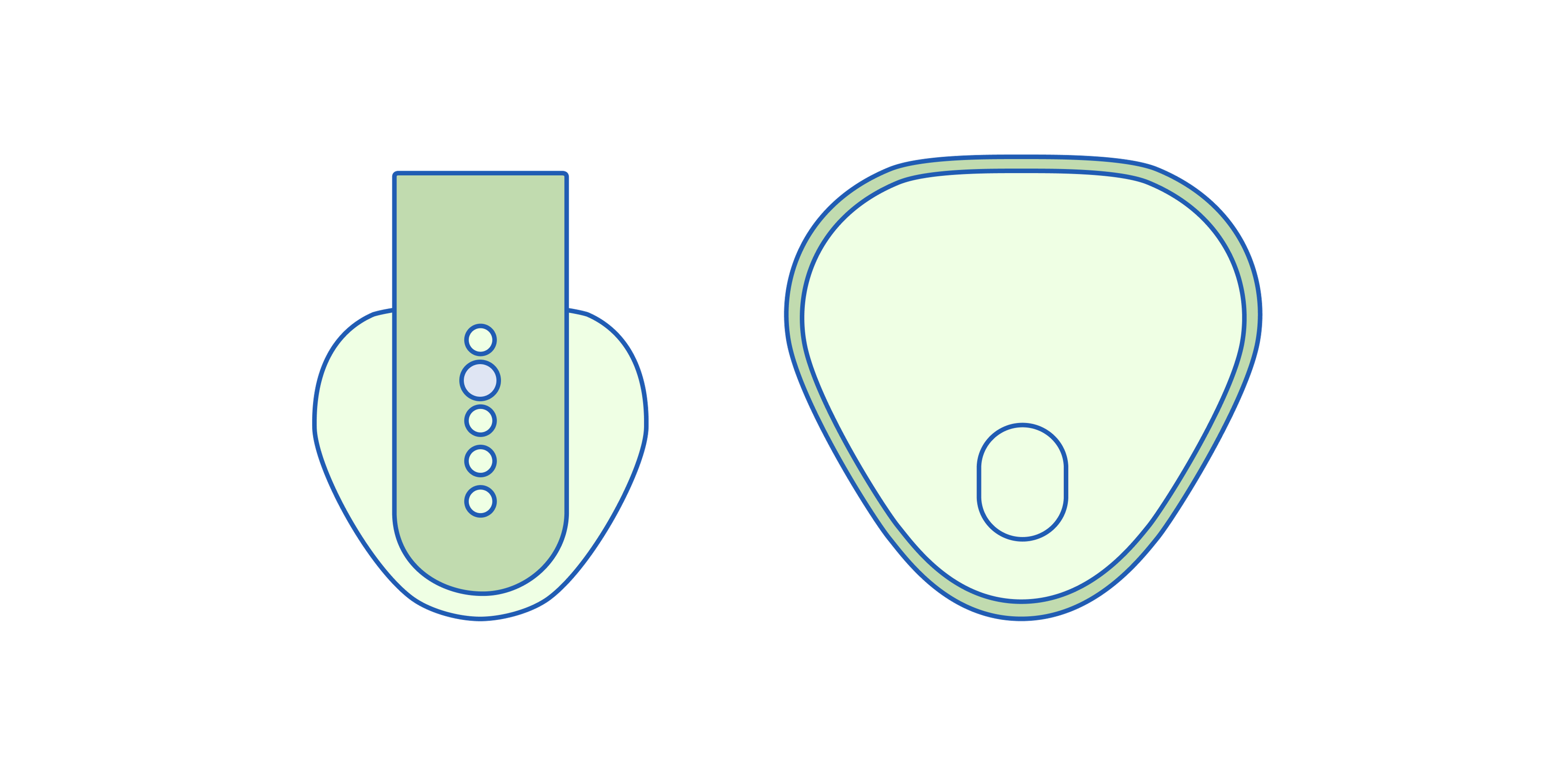 Home-based biofeedback device for stress management