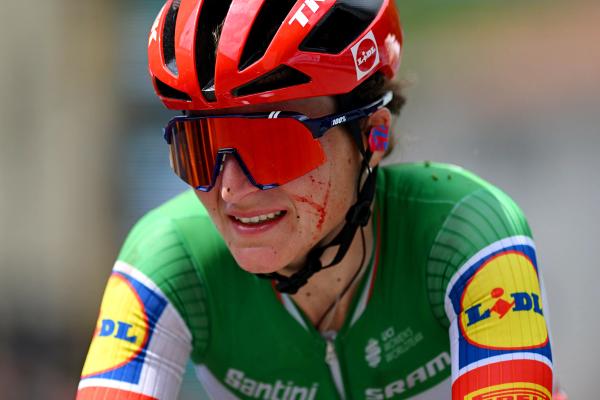 Elisa Longo Borghini finished the stage with a bloodied face following her dramatic crash