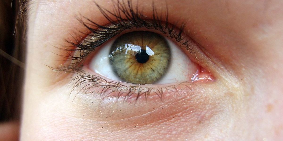Can I catch your eye?